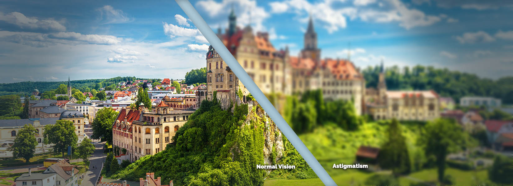 Astigmatism Treatment in South Denver