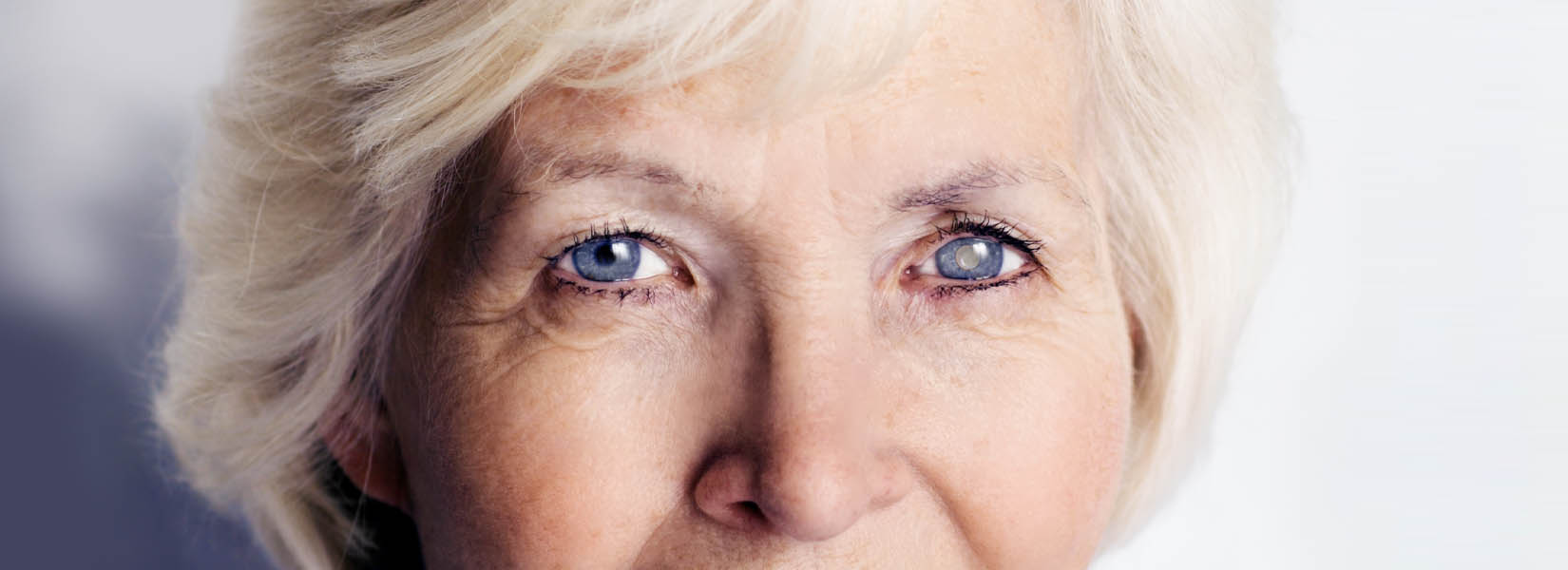 Cataract Surgery in South Denver
